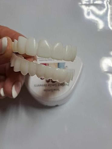 Beauty & Care: Snap on Smile navlake za zubeCena:2500din/par 1900din/Gornja ili at lalafo.rs — 3 Beauty & Care: Snap on Smile navlake za zubeCena:2500din/par 1900din/Gornja ili — 3