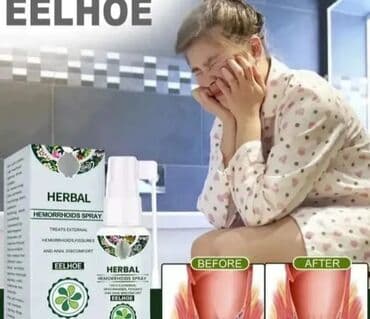 EELHOE Herbal Hemorrhoids Spray – biljni sprej za spoljne hemoroide na lalafo.rs EELHOE Herbal Hemorrhoids Spray – biljni sprej za spoljne hemoroide