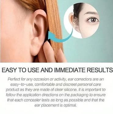 02. Flasteri za korekciju ušiju - 6 komada Cena:1599din/pakovanje 🌿 na lalafo.rs — 3 02. Flasteri za korekciju ušiju - 6 komada Cena:1599din/pakovanje 🌿 — 3