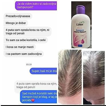 cista koza broj: ❄️ Šampon protiv peruti – čista kosa, zdravo teme! 🧴 Zaboravi na na lalafo.rs — 2 cista koza broj: ❄️ Šampon protiv peruti – čista kosa, zdravo teme! 🧴 Zaboravi na — 2