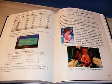 Quality of Life After Open Heart Surgery - Radovanovic, Jakovljevic na lalafo.rs Quality of Life After Open Heart Surgery - Radovanovic, Jakovljevic