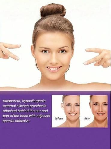 02. Flasteri za korekciju ušiju - 6 komada Cena:1599din/pakovanje 🌿 na lalafo.rs — 2 02. Flasteri za korekciju ušiju - 6 komada Cena:1599din/pakovanje 🌿 — 2